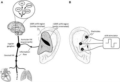 Current Directions in the Auricular Vagus Nerve Stimulation II – An Engineering Perspective